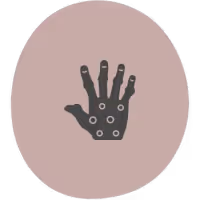 Artrosis