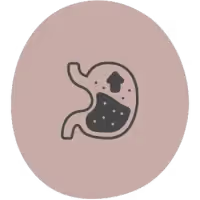 Reflux